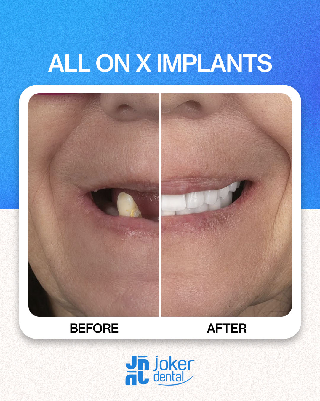 İsdentbul Before After 7